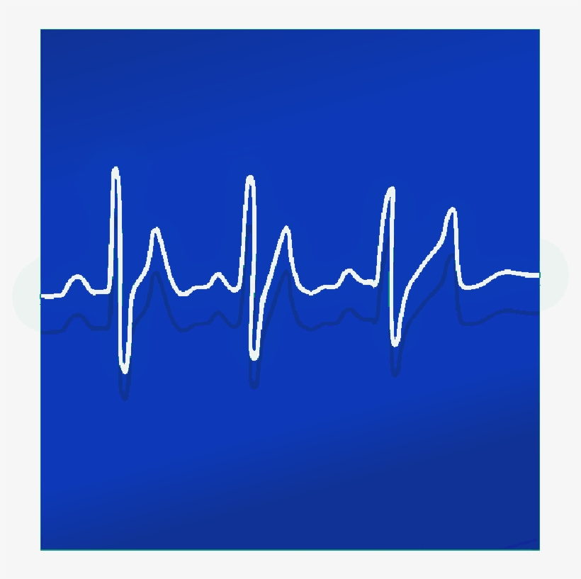Mb Image/png - Electrocardiography, transparent png #272210