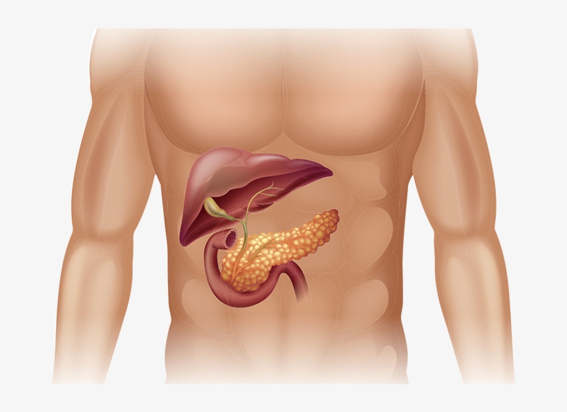 Pancreatic Cancer In Body - Human Pancreas, transparent png #2728162