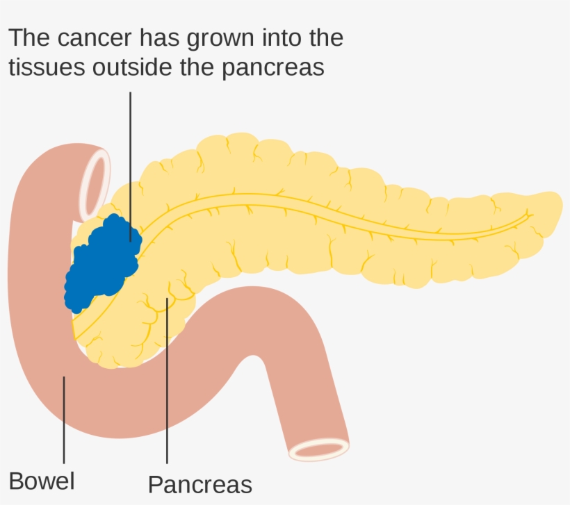 Open - Pancreas Diagram Png, transparent png #2728233