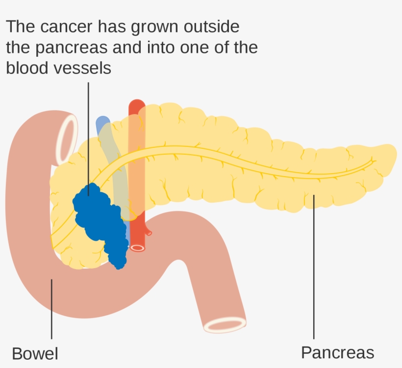 Open - Humboldt Clothing Company, transparent png #2728424
