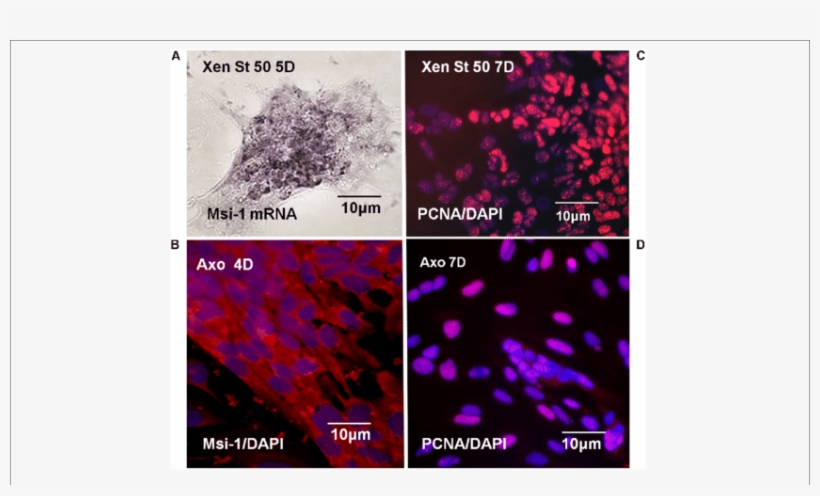 Xenopus And Axolotl Msi 1, Proliferation In Vitro - Riboprobe, transparent png #2752465