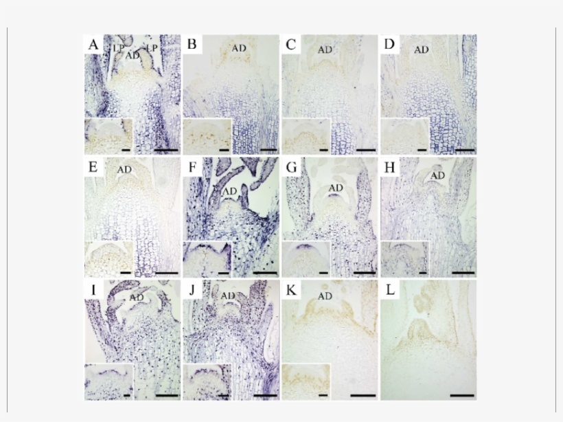 In Situ Localization Of Csvd In Infected In Vitro Culture - Shoot, transparent png #2753848