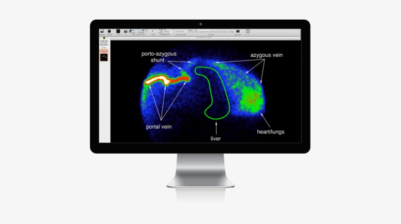 Mac Display Overlay Portoazygousshunt - Advanced Veterinary Medical Imaging, transparent png #2787026