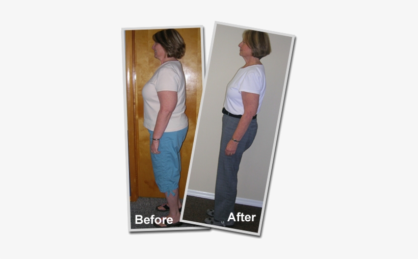 Hcg Before And After Weight Loss Pictures Pat - Hcg Success Stories, transparent png #2792732