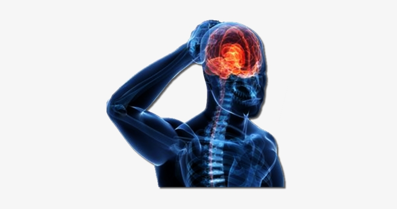 Head Injury - Brain Concussion Png, transparent png #2798868