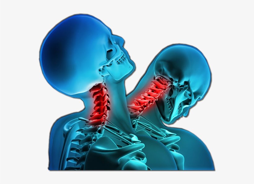 Whiplash Injury, transparent png #2798967