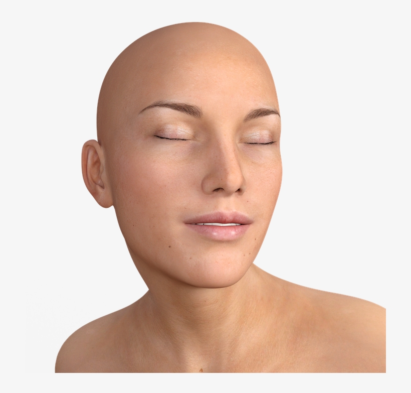 Bald Hair Png - Botox Områden, transparent png #2801881
