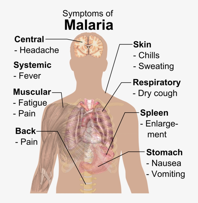 Symptoms Of Malaria, transparent png #2813926