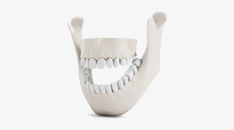 Illustrated Full Mouth Reconstruction In Austin Tx - Tmj Treatment, transparent png #2818447