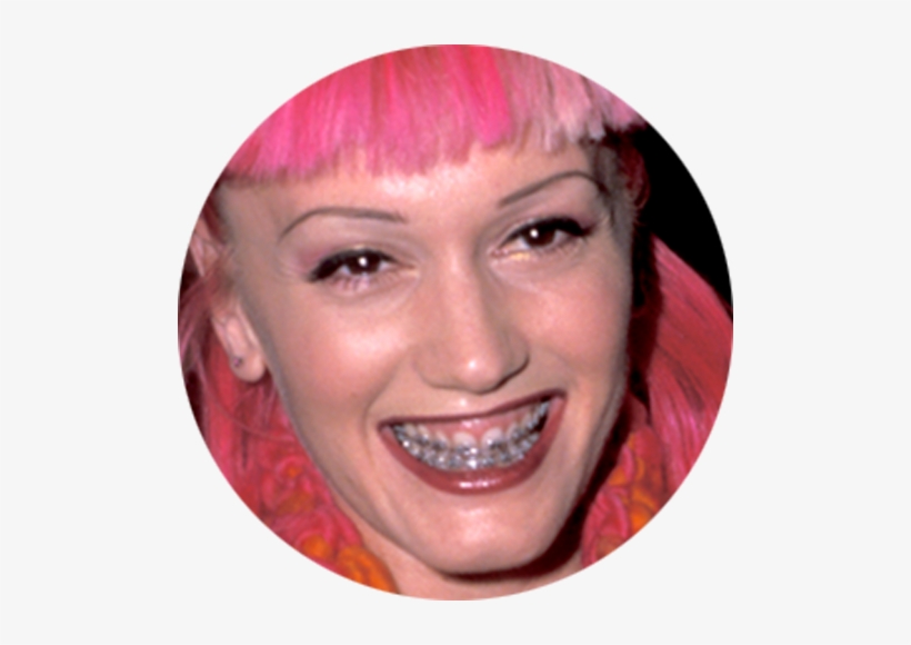 Gwen Stefani Was Another Famous Face Who Was Brave - Gwen Stefani Botox Plastic Surgery, transparent png #2828117