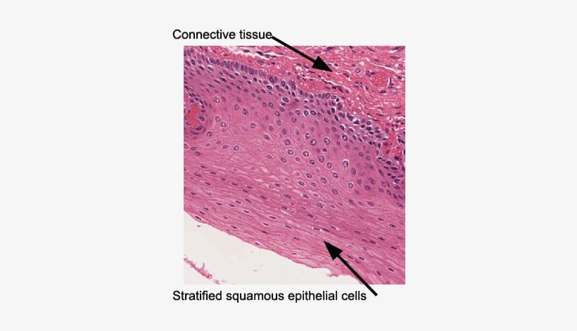 Esophagus Epithelia - Stratified Squamous Epithelium Microscope, transparent png #2844249
