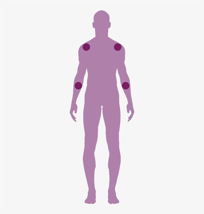 Arm Pain - Pain, transparent png #2846457