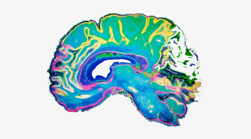 Brain Scan Transparent - Green Tea Good For Brian, transparent png #2852886