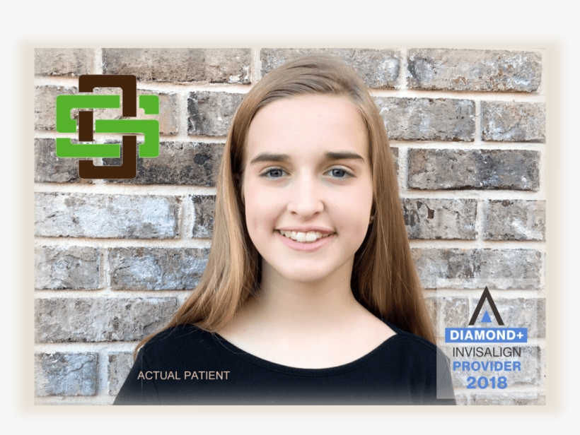 View Our Video Blogs - Spillers Orthodontics, transparent png #2867883