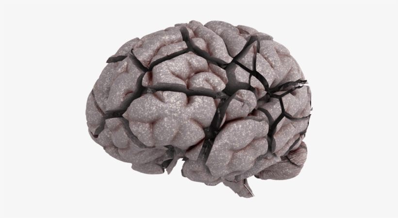 Choose A 'brain Break Or A Brain Brake' Making Choices - Bone Fracture, transparent png #2868107