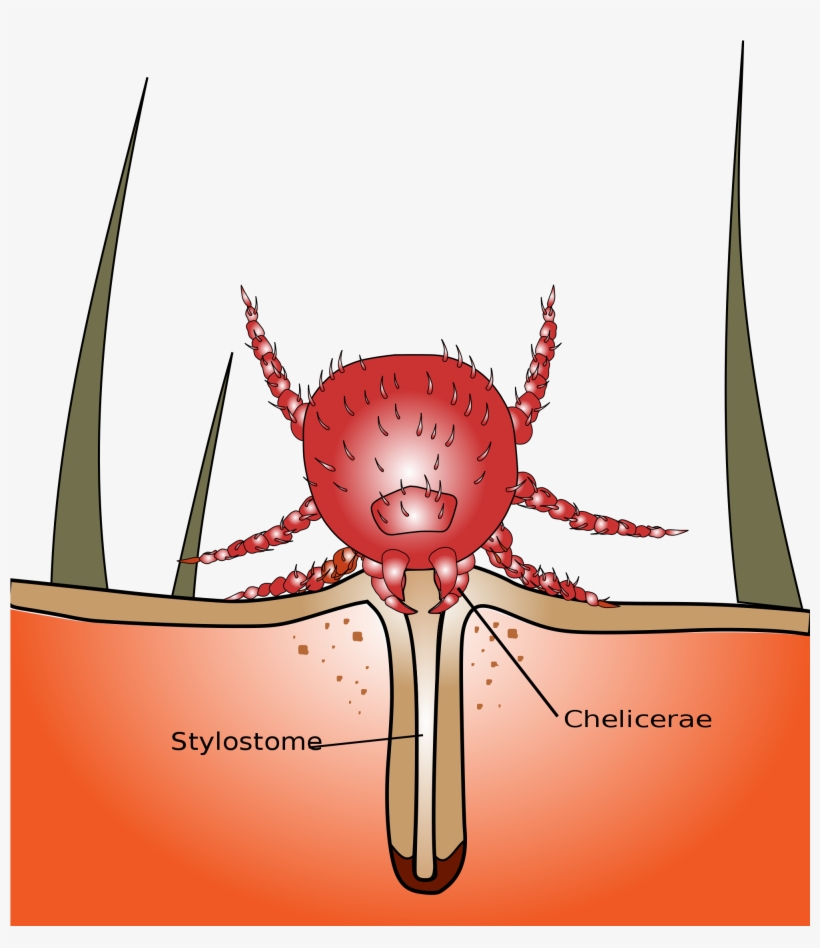 Open - Chigger Bug, transparent png #2871929