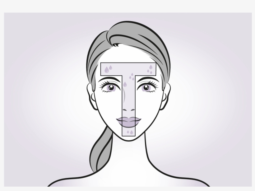 What Happens During The Procedure - Illustration, transparent png #2874249