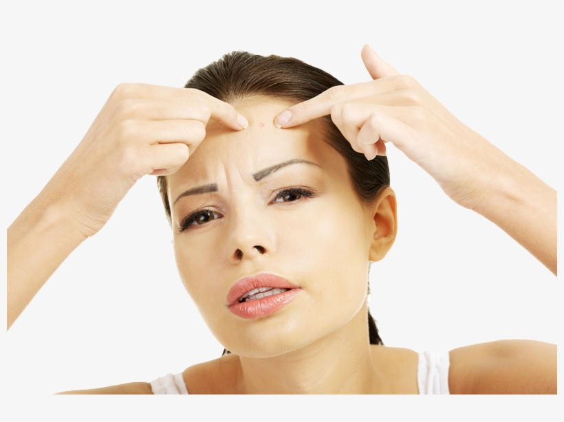 You Have A Giant Fucking Zit - Skinosm Pimple Popper Tool Curved Tweezers Metal Blackhead, transparent png #2881560