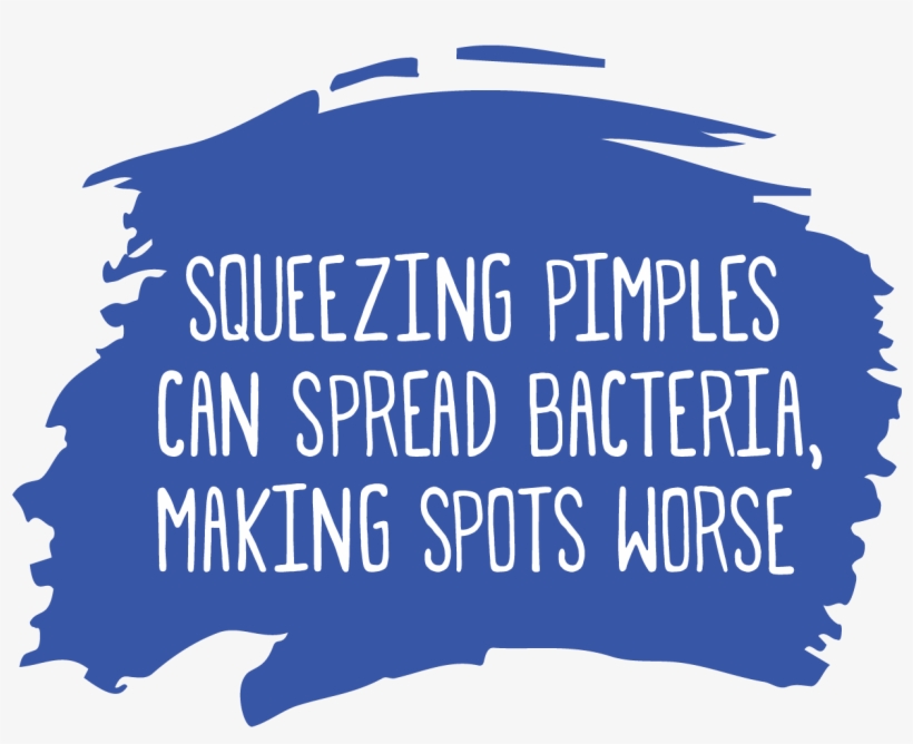 Squeezing Pimples Can Spread Bacteria, Making Spots - Acne, transparent png #2882074