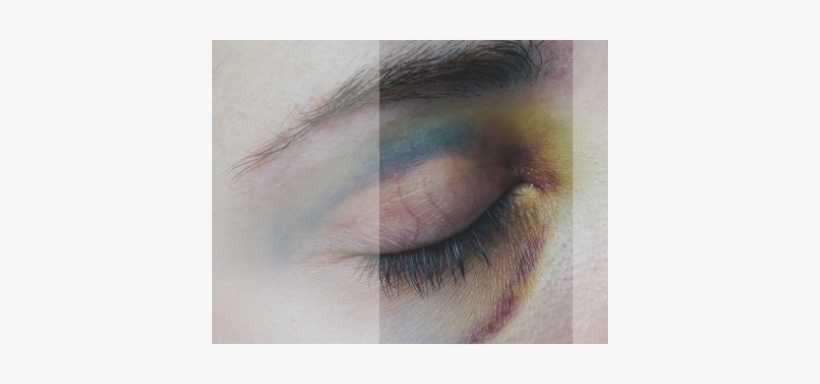 Helatomic-bruises - Cracked Spines, transparent png #2928224