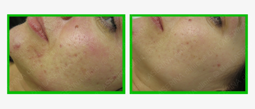 Before And After - Baby, transparent png #2968356