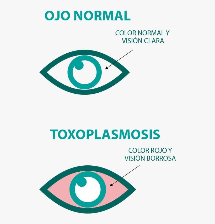 Otra Vía Para Contraer Esta Enfermedad Es La Leche, transparent png #2976673