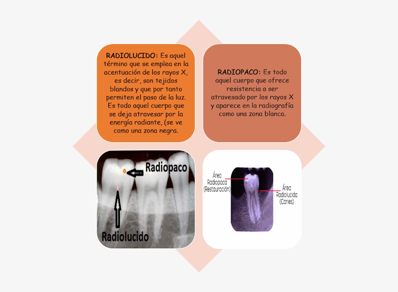 Radio, transparent png #2977306