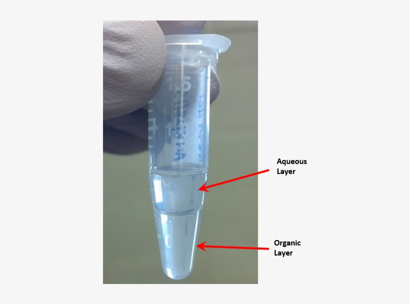 Aqueous Layer - Aqueous Layer In Dna Extraction, transparent png #2990196