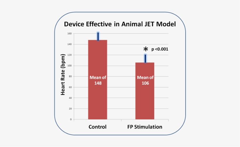 Direct Electrical Stimulus To The Av Node Lowers The - Diagram, transparent png #3098311