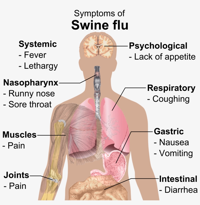 Symptoms Of Swine Flu - Swine Flu Symptoms, transparent png #312258