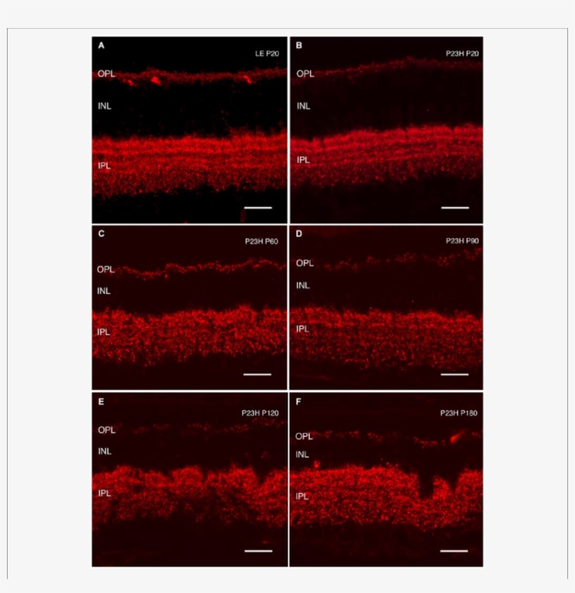 Cryostat Sections Stained Against Bassoon To Visualize - Immunostaining, transparent png #3124306