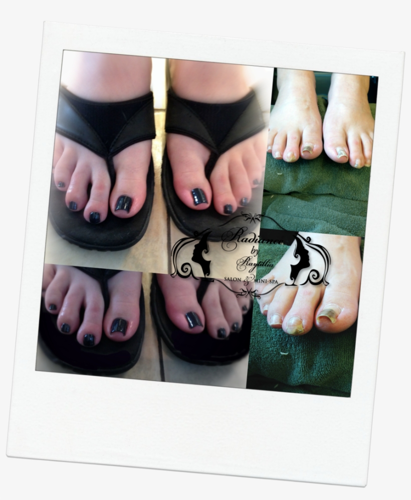 Http - //www - Radiancebyraytillia - Com/wp - Toe, transparent png #3147411