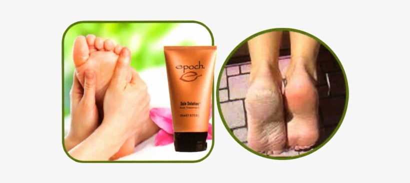 Natural Ice Dancer Pedicure - Nu Skin Sole Solutions Foot Treatment, transparent png #3147477