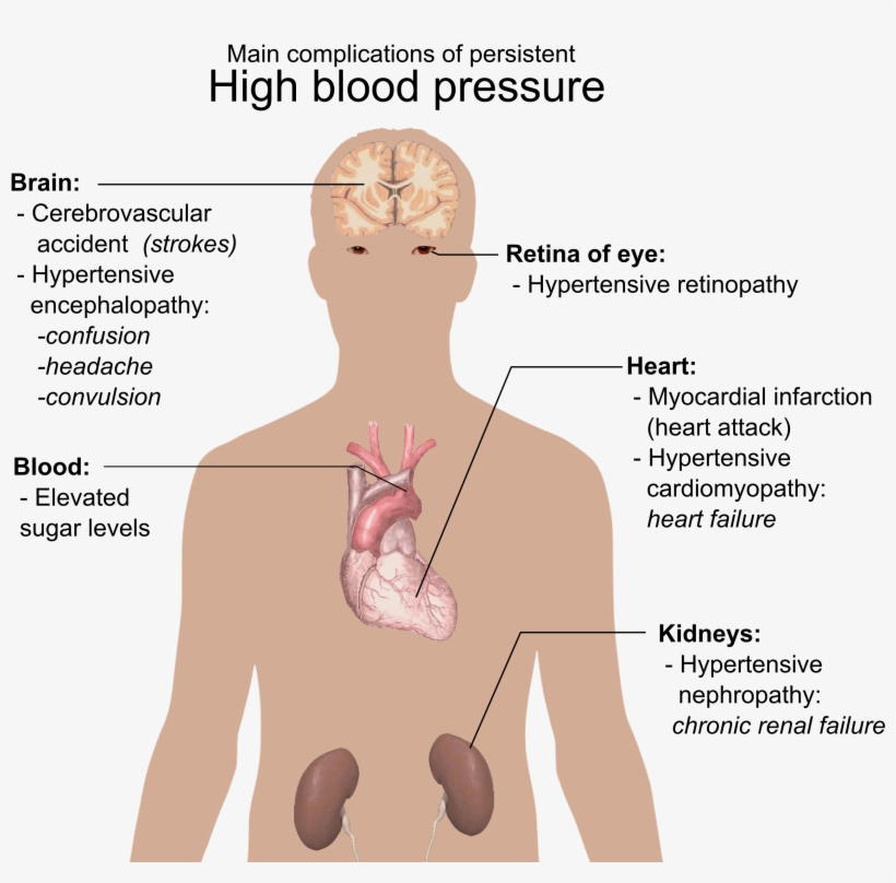 Main Complications Of Persistent High Blood Pressure - Do You Know If You Have High Blood Pressure, transparent png #3166462