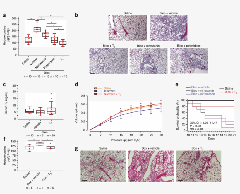 Aerosolized T 3 Blunts Established Fibrosis In Two - Pulmonary Fibrosis, transparent png #3188871