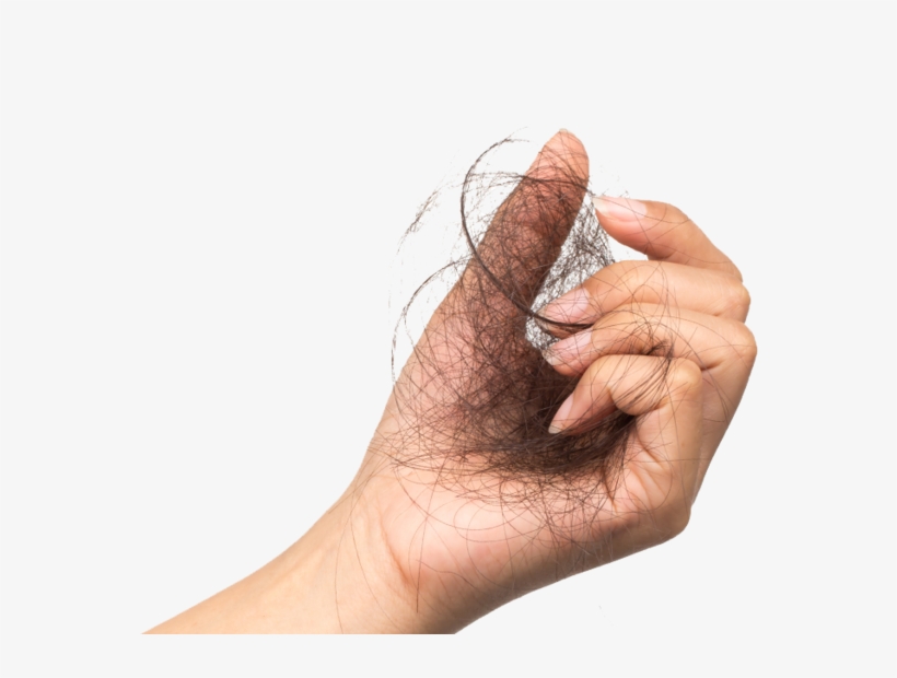 Experience Hair Loss At Some Time In Their Lives - Tea, transparent png #320513