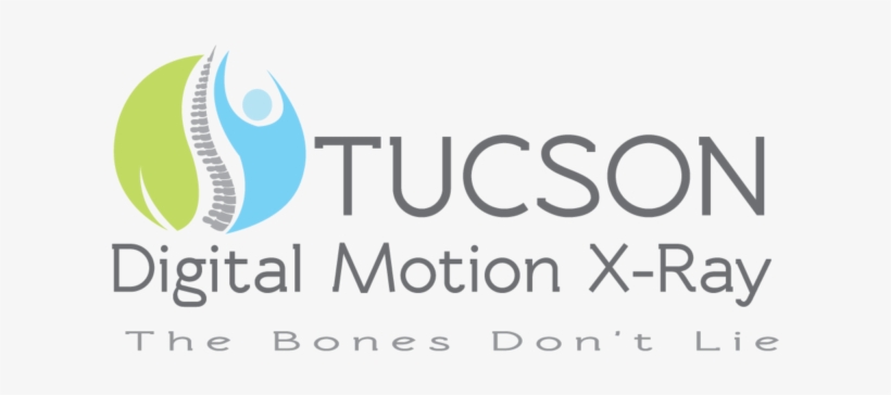 Seeing Instability - Tucson Digital Motion Xray, transparent png #3219686