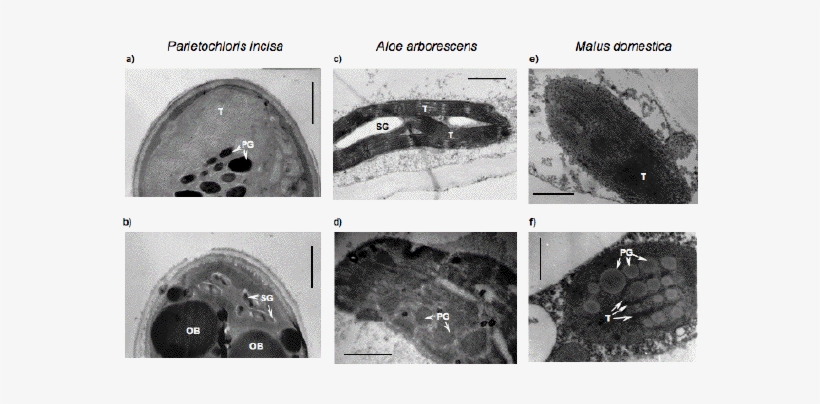 The Changes In Plastid Ultrastructure Of Microalgae - Medical Imaging, transparent png #3268284