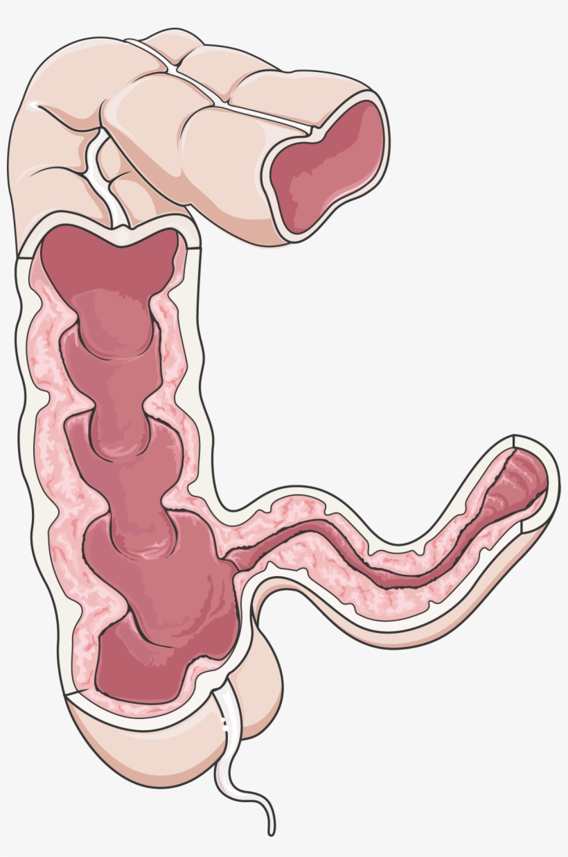 Similar - Large Intestine, transparent png #3286450