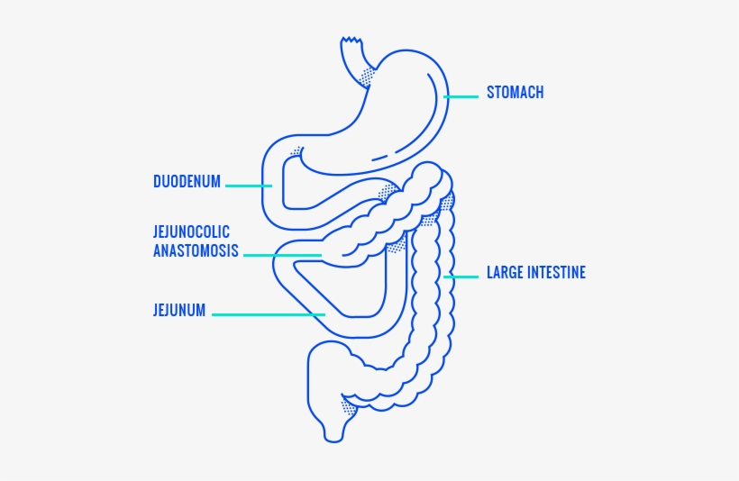 Jejunocolic Anastomosis And The Digestive System - Human Digestive System, transparent png #3286556