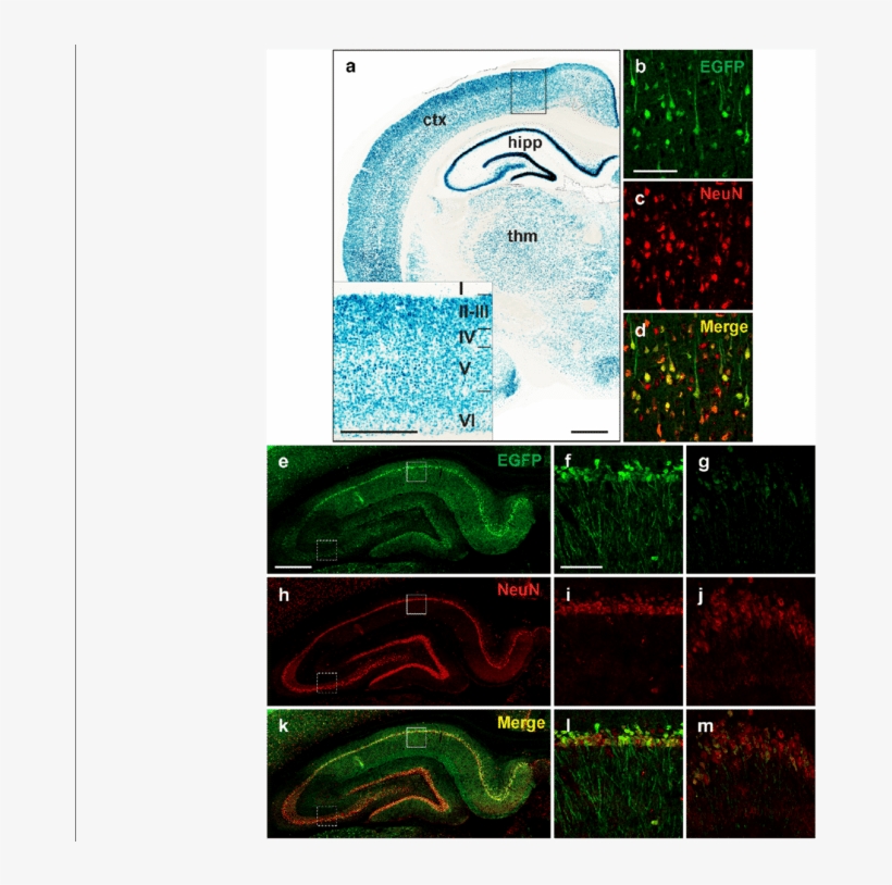 Raprnp Vector Drives Expression In Rat Neurons - Visual Arts, transparent png #3316850