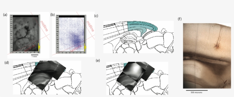 Image (intrinsic Imaging To Find A Parallel V1 Slice - Sketch, transparent png #3317236
