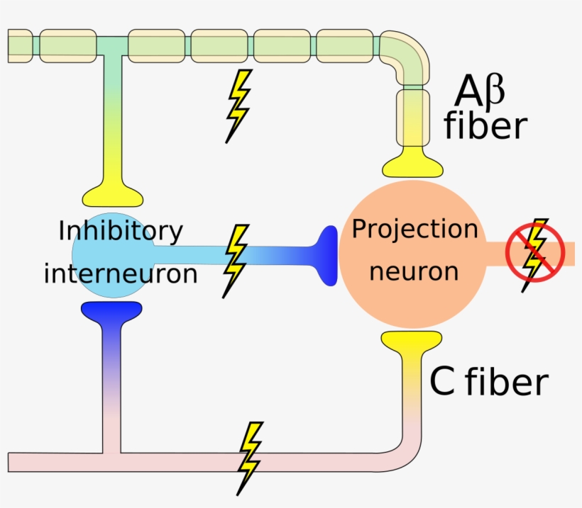 Gate Control Theory, transparent png #3317240