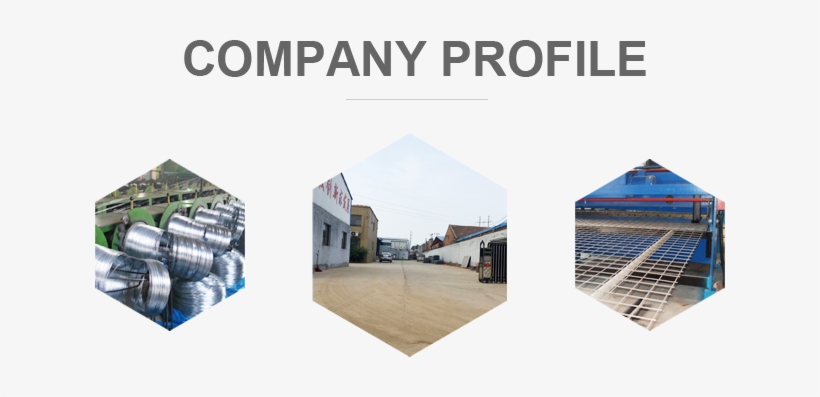 Hebei Xiyue Hardware Mesh Products Co - Profile Picture Coming Soon, transparent png #3318584