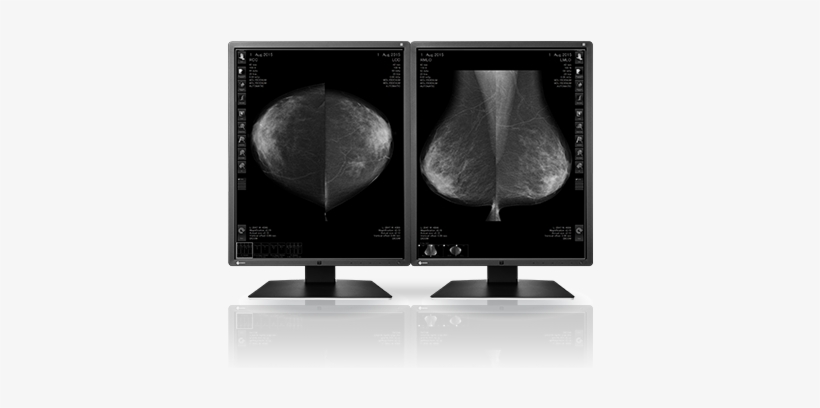 1cm Monochrome Lcd Monitor - Radiforce Gx550-p-bk - 21.3" Ips Led Monitor - 4:5, transparent png #3386114