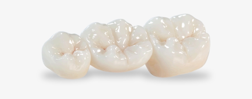 Bruxzir® Solid Zirconia Crowns And Bridges - Zirconia Crowns And Bridges, transparent png #3391855