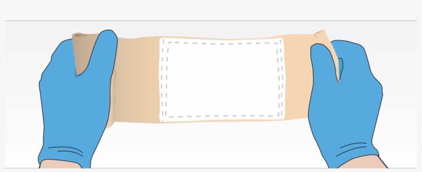 If You See The White Pad When You Open The Dressing, - Pressure Dressing, transparent png #3411713