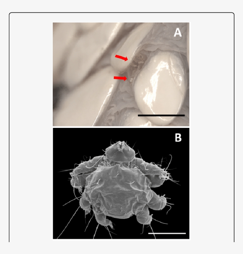 Of Mites Embedded Beneath The Scales Of The Infralabial - Computed Tomography, transparent png #3488333