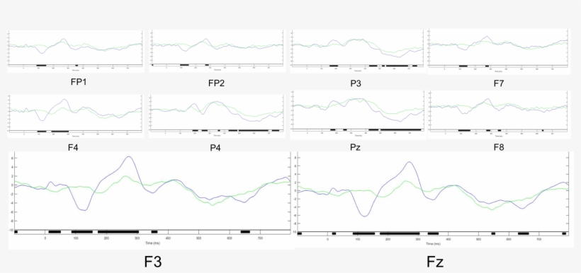Results Of Erps On 10 Channels With A Significant Difference - Diagram, transparent png #354004
