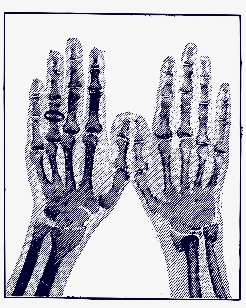 This Free Icons Png Design Of X-ray Image, transparent png #3505827